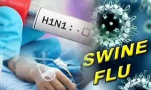 CG में स्वाइन फ्लू की दस्तक; 2 साल 11 माह की बच्ची में H1N1 की पुष्टि, स्वास्थ्य विभाग अलर्ट